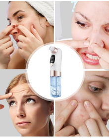 Led Projektör Lamba