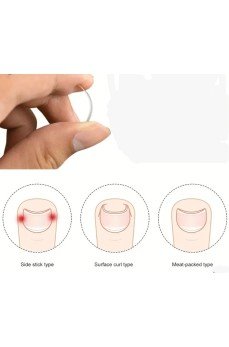 BAŞ PARMAK TIRNAK BATMASINI ENGELLEYEN METAL APARAT NRD 603 ***