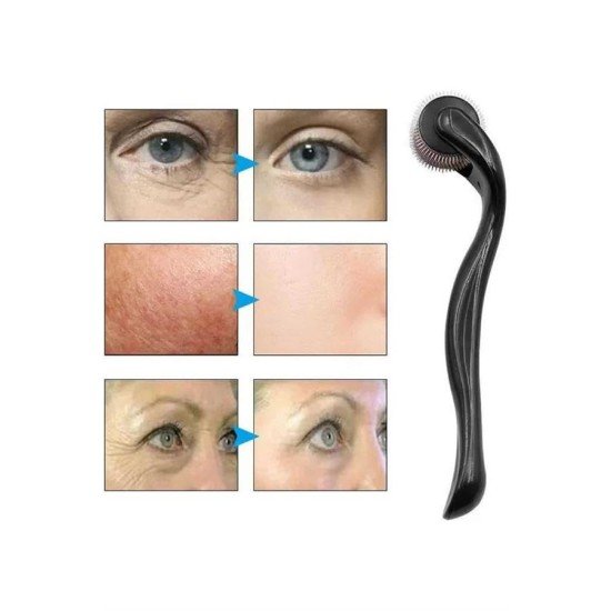 Dermaroller Titanyum 540 Iğneli 1 Mm Saç Kaş Sakal Serum Kullanıma Uygun