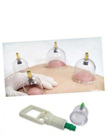 Hacamat Seti - Vakumlu Kupa Çekme Seti (Model 1)