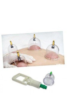 Hacamat Seti - Vakumlu Kupa Çekme Seti (Model 1)