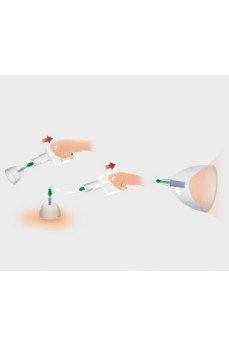 Vakumlu Göğüs Büyütücü Vakumlu Göğüs Büyütücü